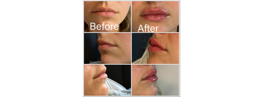 Lavinia Health and Redlips Aesthetics