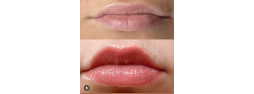 KVG Beauty