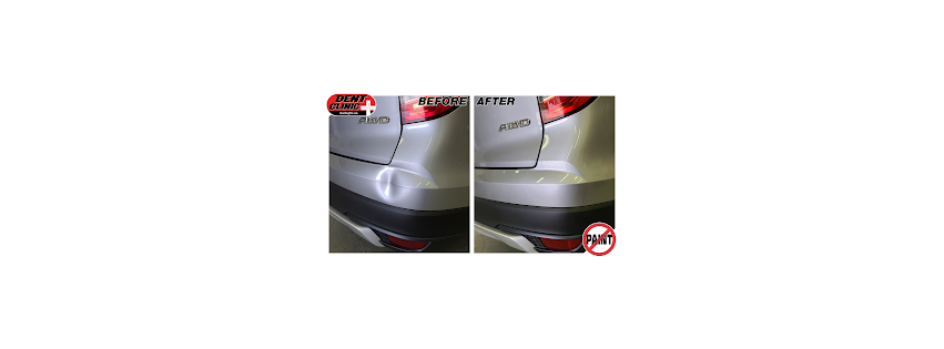 Dent Clinic – Paintless Dent Removal and Repair