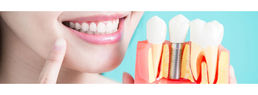 Timberline Oral Surgery & Dental Implants - South Hill