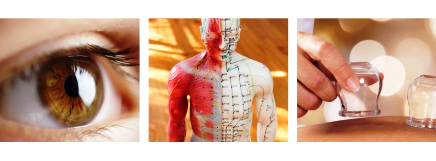 Arkansas Acupuncture