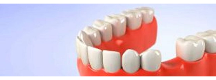My Family Dental - Novi